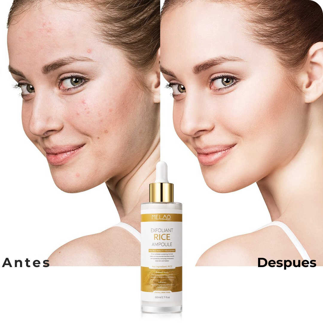 Ampollas exfoliantes de Arroz y Niacinamida™