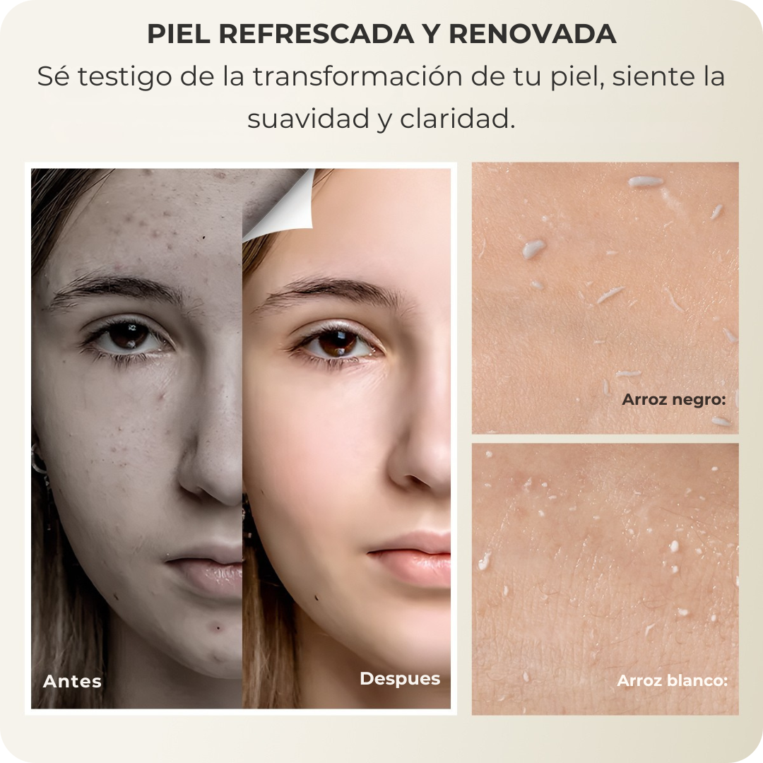 Ampollas exfoliantes de Arroz y Niacinamida™